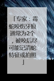 专家：毒蛇咬伤牙痕通常为2个，被咬后尽可能记清蛇特征或拍照